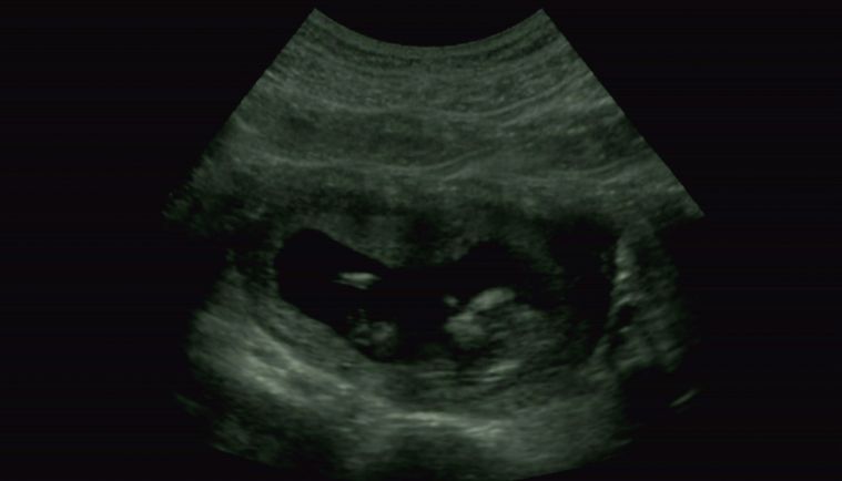 The exclusive world premiere of Beyonce's 'Lemonade' on HBO